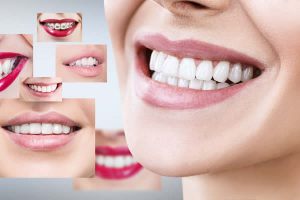 Rejuvenate your smile with teeth whitening treatment at Dakota Orthodontics in Fargo, North Dakota.